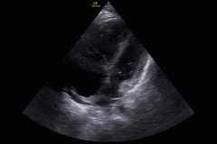 instance_data_23541839f8ab15c79e71d28318045d98be83f712-0-burned_in_crop