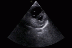 instance_data_c48713fe084abedcbc9d6f29ea03985723eb4d38-0-burned_in_crop