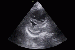 instance_data_d1acc94bb5b2d1addc65afcd05fddb19ebeecba0-0-burned_in_crop