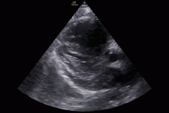 instance_data_ef063b625fa01c9f219e14ead41d22d84fcfee05-0-burned_in_crop